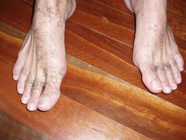 photo of my hairy feet